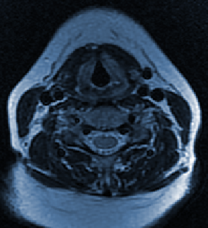 Pharynx and larynx