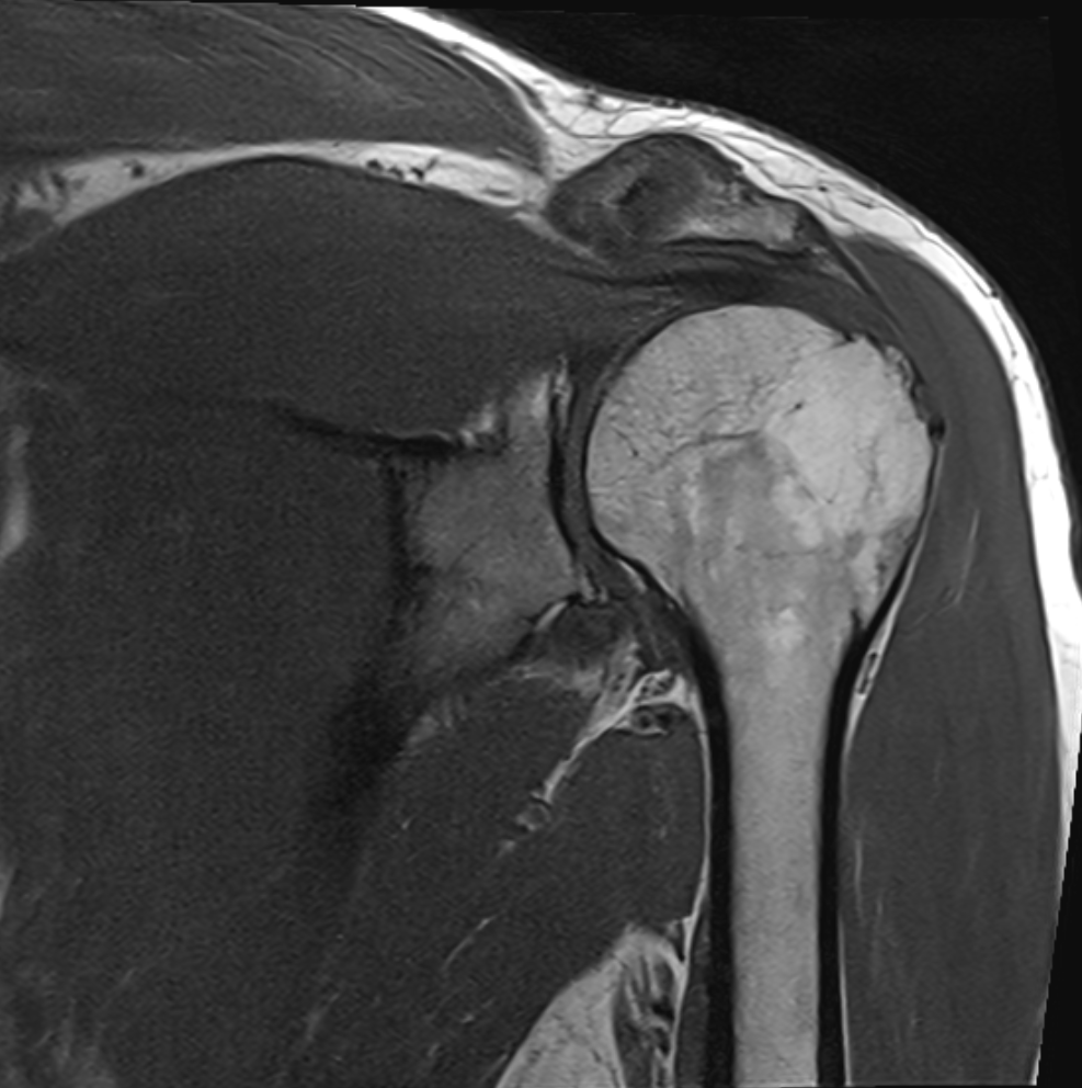 MRI bark – średnio zaawansowany