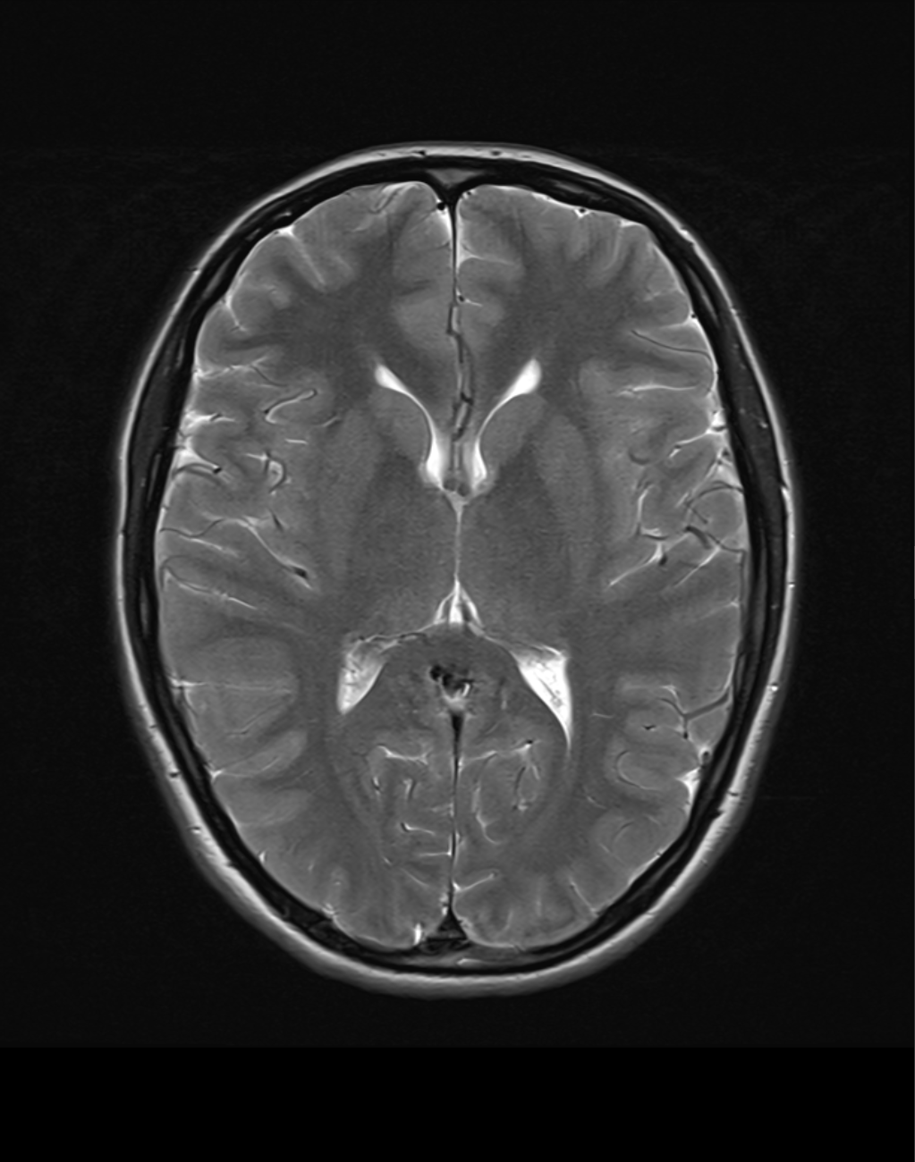 Neuroradiologia dla początkujących